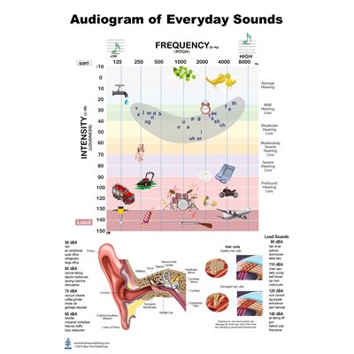 Blue Tree Audiogram educational poster, 24 by 36 inches