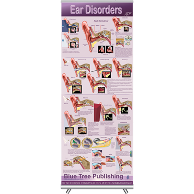 Blue Tree Ear Disorders wall-hanging poster, 30 x 84 inches, BT-4122033