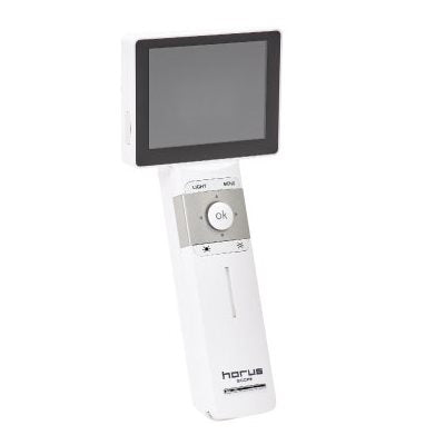 Horus Pro Digital Video Otoscope (39-7410)