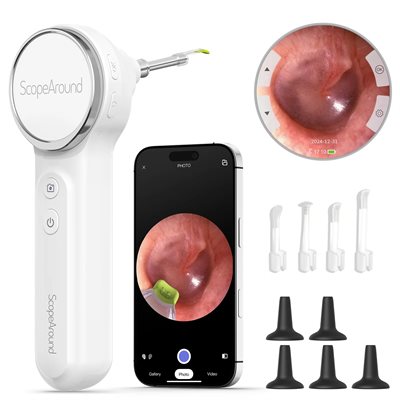 ScopeAround SA200 digital video otoscope with screen
